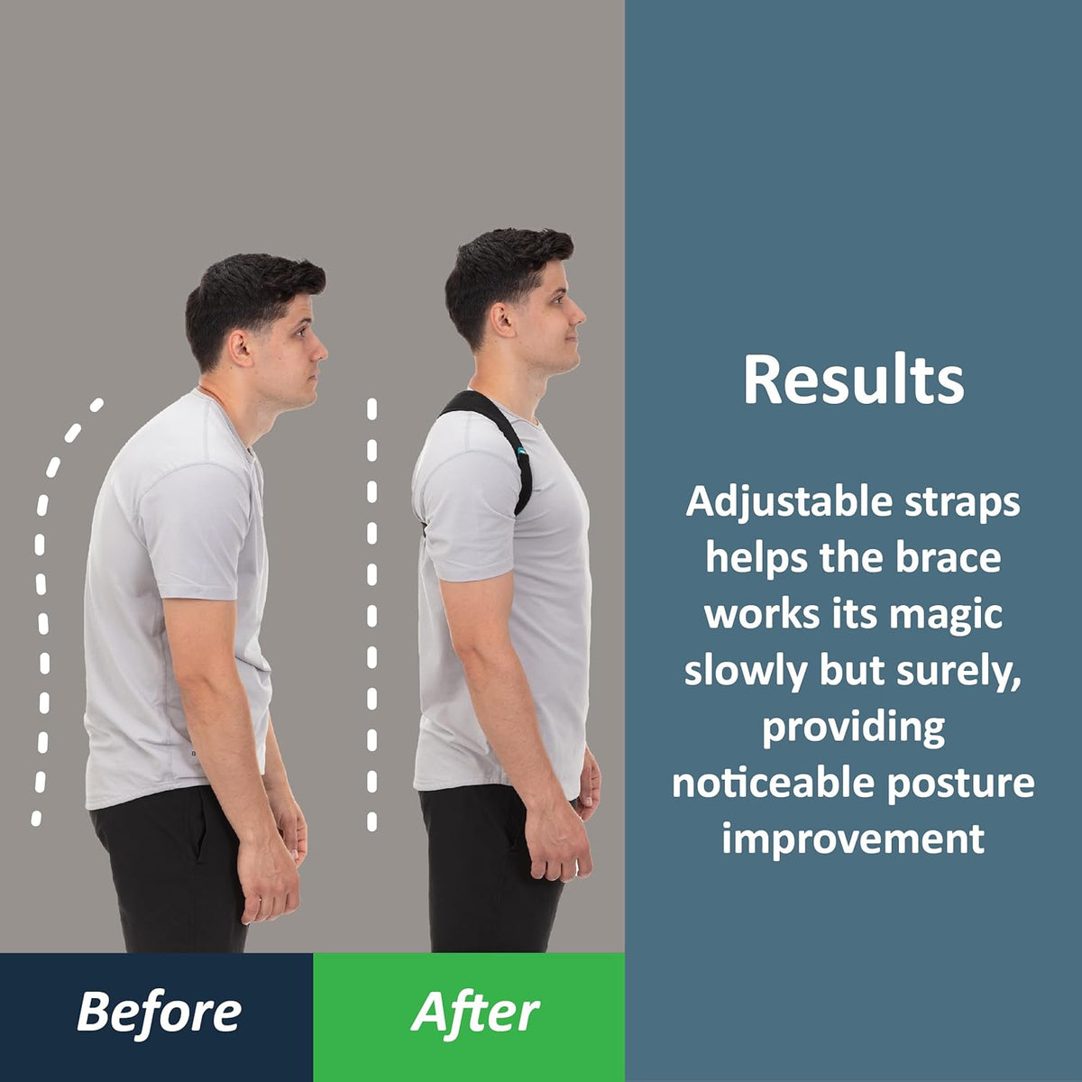 Comfy Brace Posture Corrector